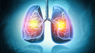 Akciğer Kanserinin Bir Numaralı Nedeni Sigara