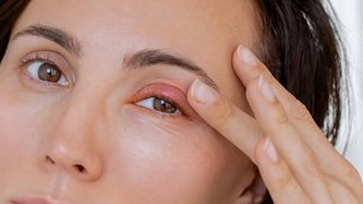 Arpacık Nedir? Arpacık Neden Çıkar ve Nasıl Geçer?