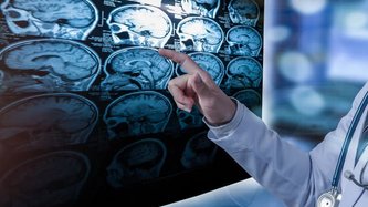 Beyin ve Sinir Cerrahisi Nedir? Hangi Hastalıklara Bakar?