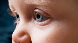 Çocuklarda Retinoblastom Nedir? Belirtileri ve Tedavisi