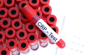 CRP Nedir? CRP Yüksekliği