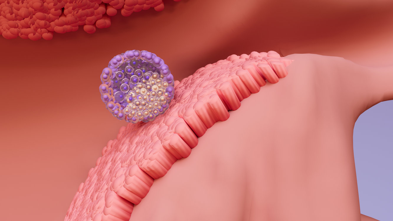 Embriyo Yapıştırıcı (Embryo Glue) Nedir? Kimlerde Kullanılır? 