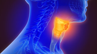 Farenks, Yutak Kanseri Nedir? Belirtileri ve Tedavi Süreci