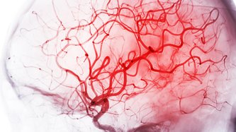 Hematom Nedir? Hematom Türleri Nelerdir?