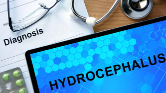 Hidrosefali Nedir? Belirtileri ve Tedavi Yöntemleri Nelerdir?