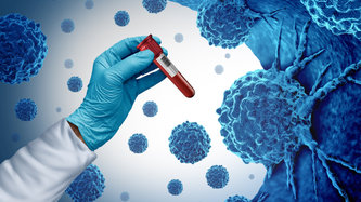 Kanser Nedir? Kanser Belirtileri ve Nedenleri Nelerdir?