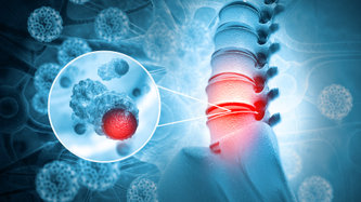 Omurilik Tümörü Nedir? Omurilik Tümörü Belirtileri ve Tedavisi