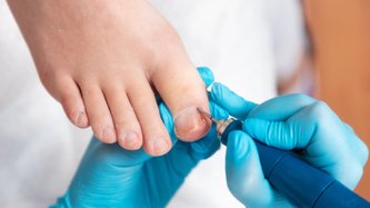 Tırnak Batması Neden Olur? Tırnak Batması Tedavisi