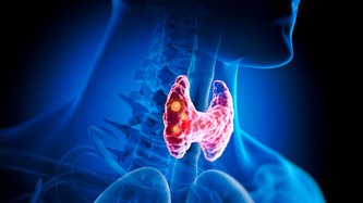 Tiroid Nedir? Tiroid Belirtileri Nelerdir?