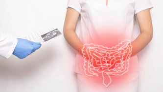 Ülseratif Kolit Nedir? Belirtileri ve Tedavisi