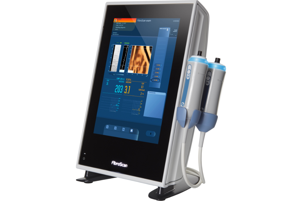 Fibroscan