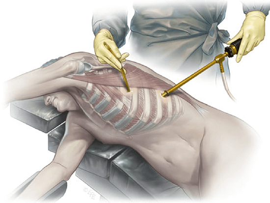 robotik-cerrahi-blog-7